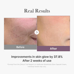 Before and after skin glow improvement with text indicating results from a clinical trial.