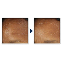 Roc Retinol Correxion Deep Wrinkle Daily Moisturizer SPF 30