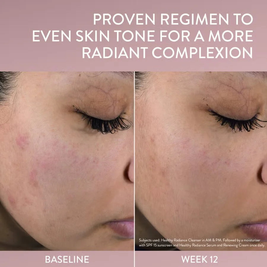 Before and after comparison of skin tone improvement with text on a pink background