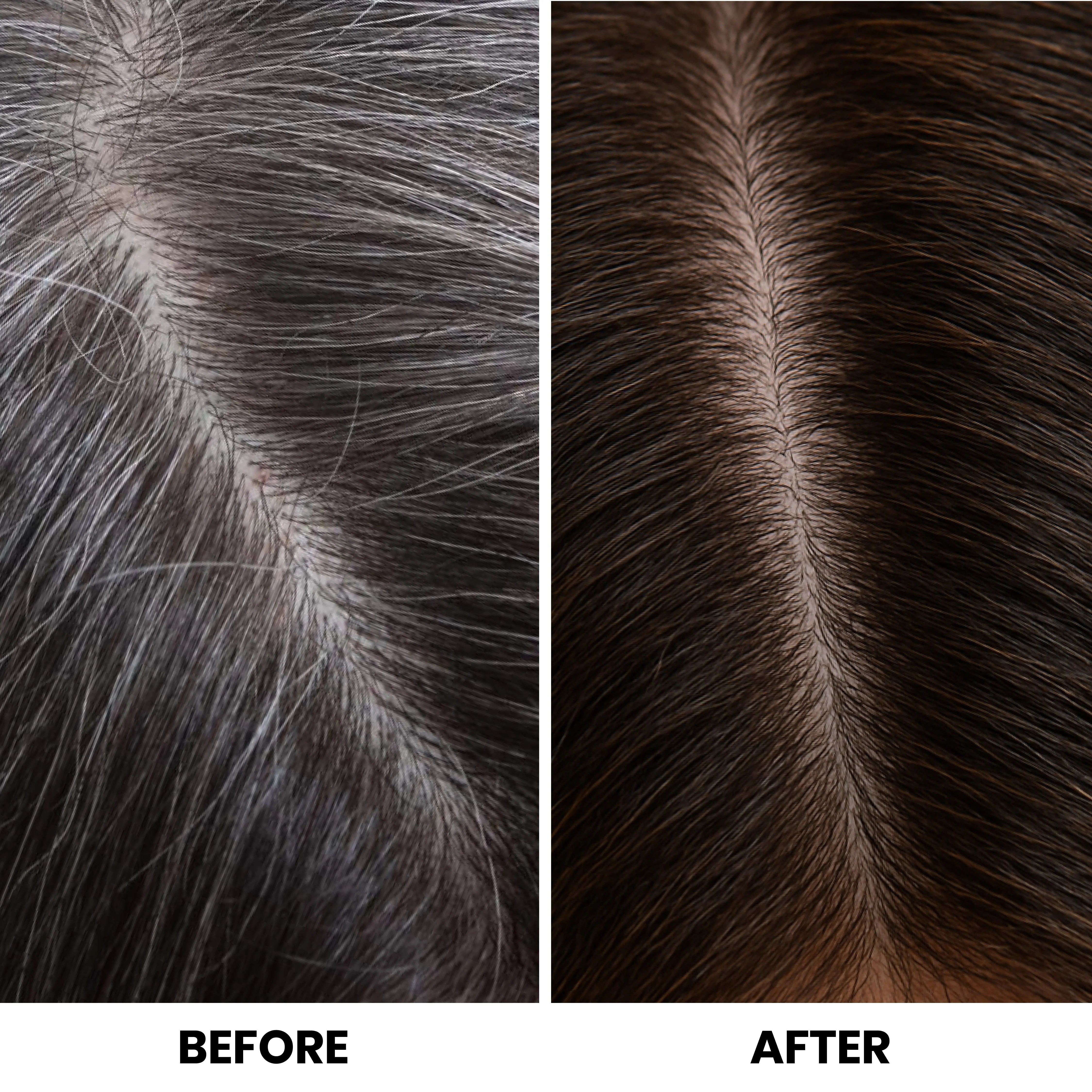 Before and after comparison of hair color treatment on a person's scalp.