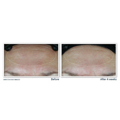 Roc Multi Correxion Hydrate+ Plump Moisturizer Spf 30