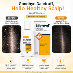 Nizoral Shampoo 2% Ketoconazole 20mg 100ml