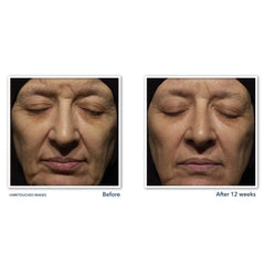 RoC Retinol Correxion Deep Wrinkle Night Cream 30 ML