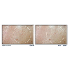 Roc Multi Correxion Even Tone + Lift Daily Moisturizer Spf 30