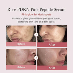 Before and after effects of Rose PDRN Pink Peptide Serum on skin with dark spots.