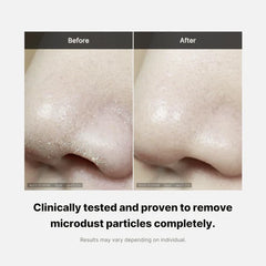 Before and after comparison of a nose with text indicating microdust particle removal.