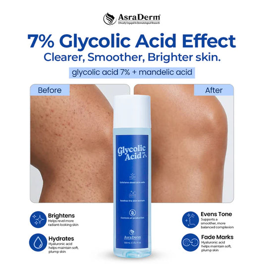 AsraDerm 7% Glycolic Acid Toner Exfoliating & Brightening Toner