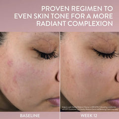 Before and after comparison of skin tone improvement with text on a pink background
