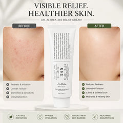 Dr Althea 345 Relief Cream 50ml
