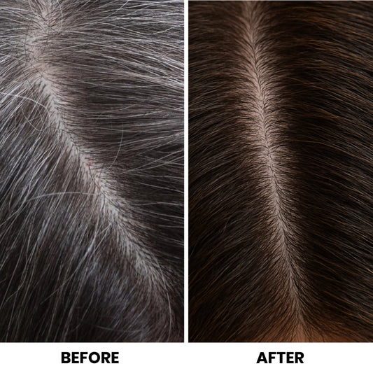 Before and after comparison of hair color treatment on a person's scalp.