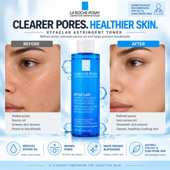 La Roche-Posay Effaclar Astringent Face Toner 200ml