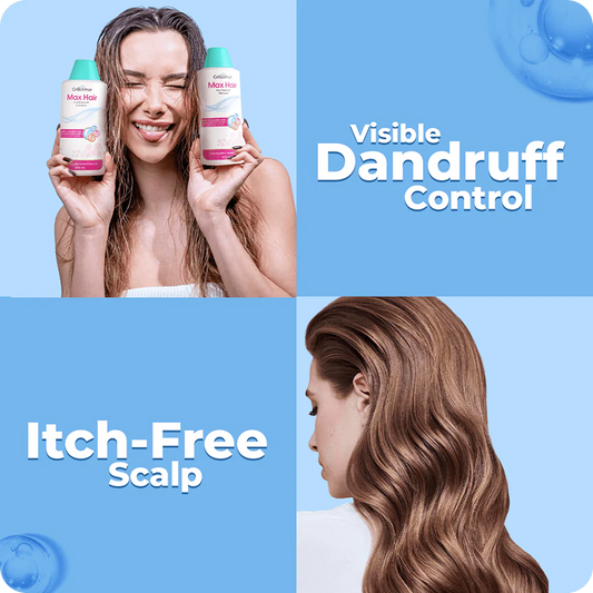 Woman holding shampoo bottles with text 'Visible Dandruff Control' and 'Itch-Free Scalp' on a blue background.