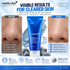 Medicube Zero Pore Blackhead Mud Mask 100g