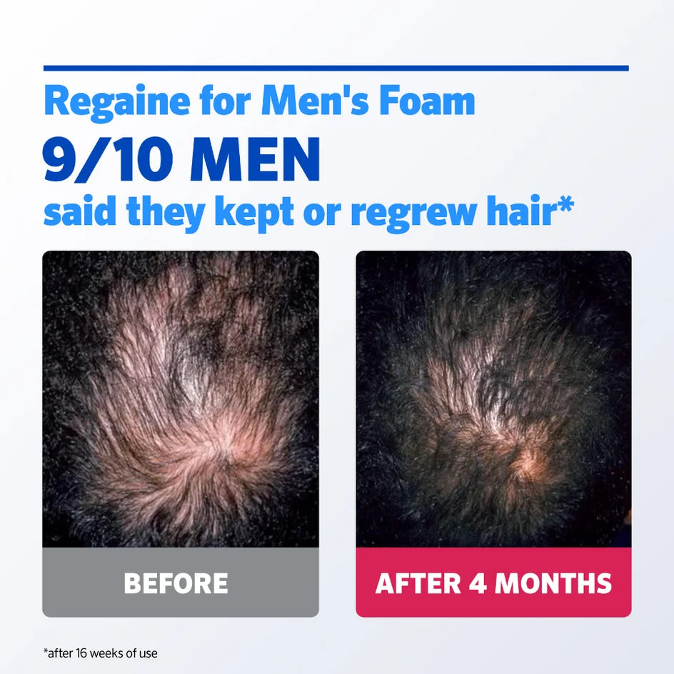 Regaine for Men Extra Strength 5% Scalp Foam 3 Month Supply