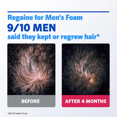 Regaine for Men Extra Strength 5% Scalp Foam 3 Month Supply