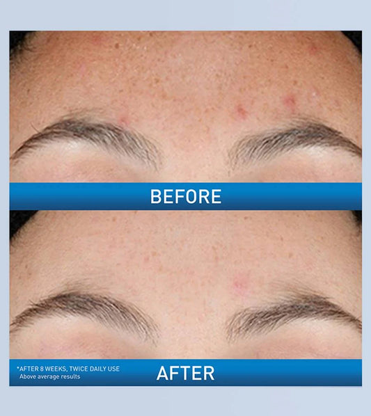 Cerave Resurfacing Retinol Serum 30ml