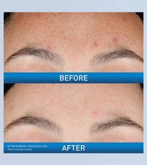 Cerave Resurfacing Retinol Serum 30ml