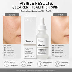 The Ordinary Niacinamide 10% Plus Zinc 1% Serum 30ml