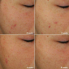 Oriflame NOVAGE+ Blemish + Age Defy Routine Light